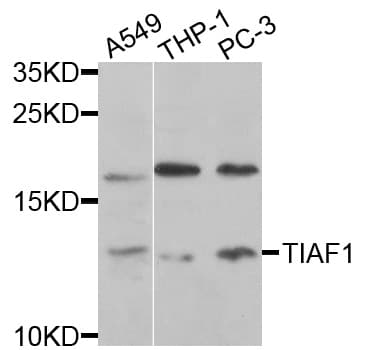 Polyclonal Rabbit anti-Human TIAF1 Antibody (WB)