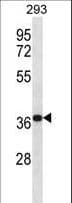 Polyclonal Rabbit anti-Human MORF4L2 / MRGX Antibody (aa259-288, WB)
