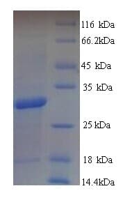 Mycobacterium tuberculosis Ag85B Protein (Recombinant 6His, N-terminus)