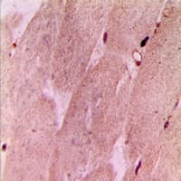 RPL3L Antibody (Internal)