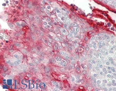 Polyclonal Rabbit anti-Human RHCG Antibody (IHC)