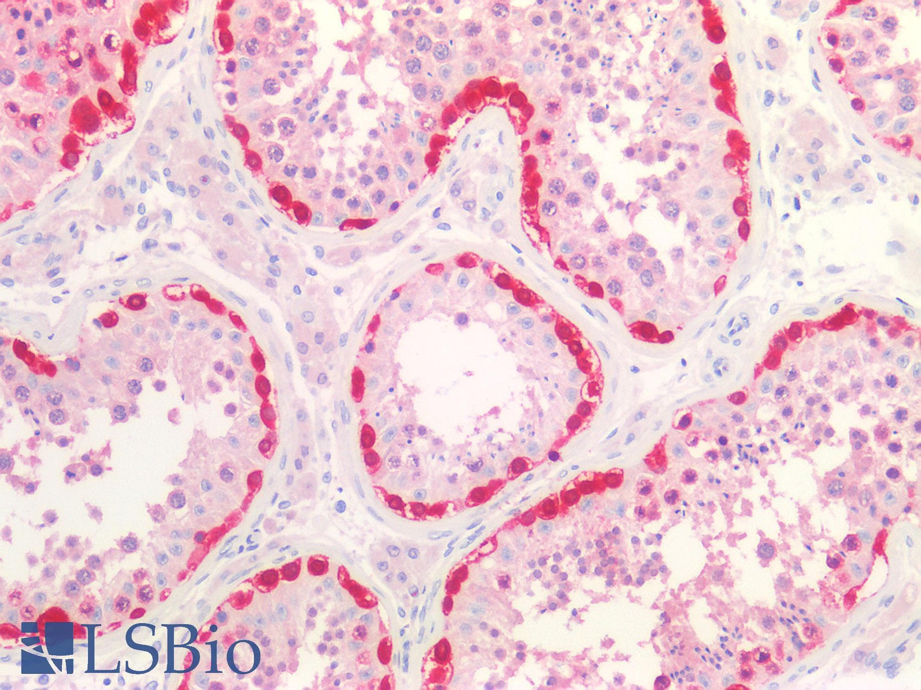 PathPlus™ MAGEA1 / MAGE 1 Antibody (C-Terminus)