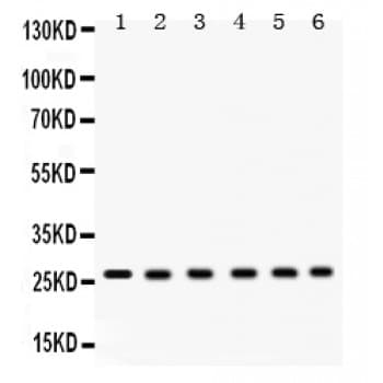 Polyclonal Rabbit anti-Human EIF6 Antibody (aa66-210, IHC, WB)