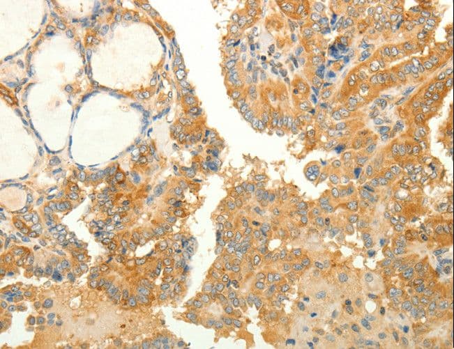 RAB35 Antibody