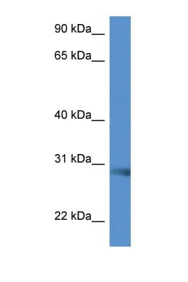 Polyclonal Rabbit anti-Mouse SCAMP5 Antibody (aa163-212, WB)