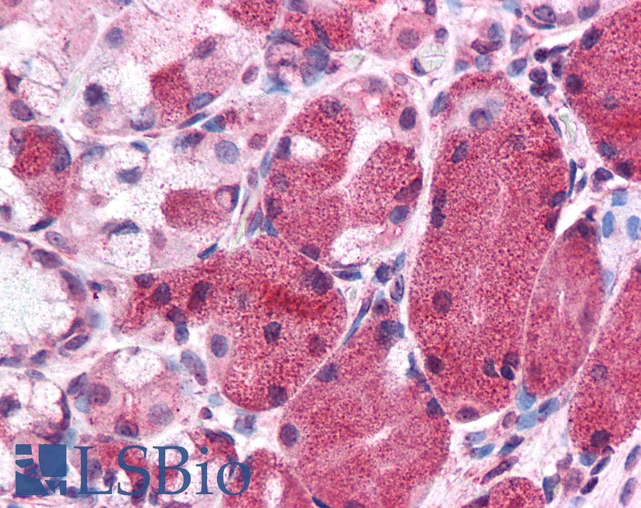 IHC-plus™ KIAA0152 / MLEC Antibody (Internal)