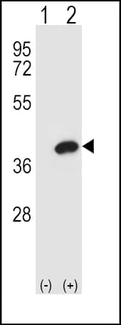 Polyclonal Rabbit anti-Human AKR1B1 / Aldose Reductase Antibody (aa102-135, IHC, IF, WB)