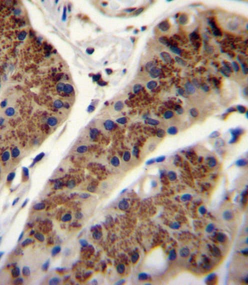INHBA / Inhibin Beta A Antibody (aa85-112)