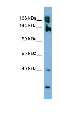 WNK3 / PRKWNK3 Antibody (aa431-480)