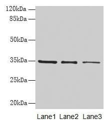GDF15 Antibody