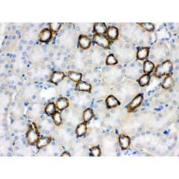 Polyclonal Rabbit anti-Human CYP1B1 Antibody (aa255-480, IHC, WB)