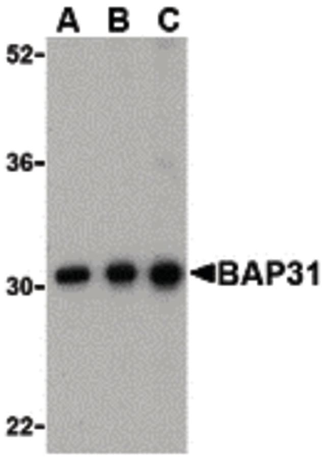IHC-plus™ BCAP31 / BAP31 Antibody