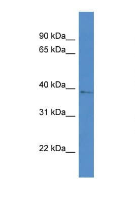 Polyclonal Rabbit anti-Human AKR1D1 Antibody (aa113-162, WB)
