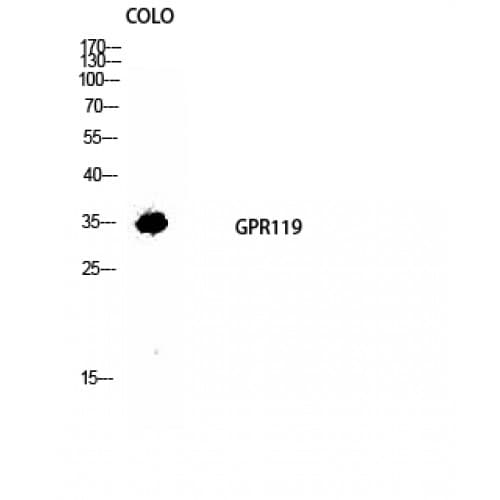 GPR119 Antibody (160-240 aa, Internal)