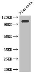 Polyclonal Rabbit anti-Human ARHGAP42 Antibody (IHC, WB)
