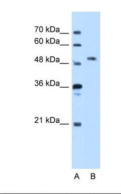 STK39 / SPAK Antibody (aa151-200, HRP)