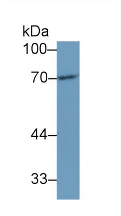 DLAT / PDC-E2 Antibody (aa368-626)