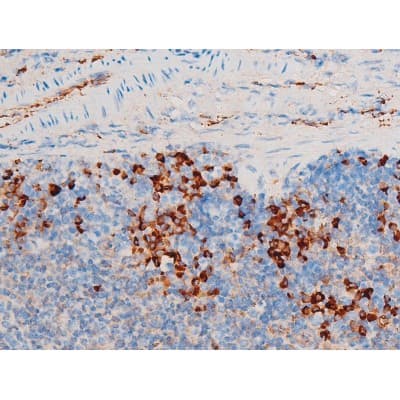 Polyclonal Rabbit anti-Human SYK Antibody (phospho-Tyr348, IHC, IF, WB)