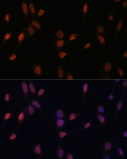 Polyclonal Rabbit anti-Human USP33 / VDU1 Antibody (IHC, IF, WB)