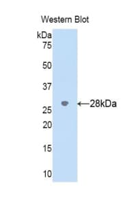CYP2D6 Antibody (aa236-472)