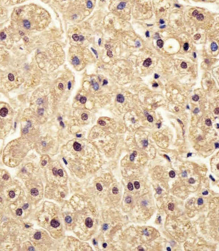 Polyclonal Rabbit anti-Human PGM1 / Phosphoglucomutase 1 Antibody (aa251-282, IHC, WB)