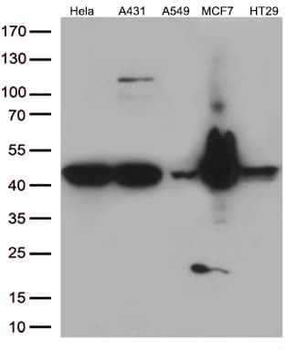 KRT18 / CK18 / Cytokeratin 18 Antibody (aa69-372, clone OTI2H10)