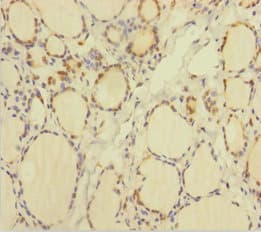 Polyclonal Rabbit anti-Human TRP32 / TXNL1 Antibody (WB)