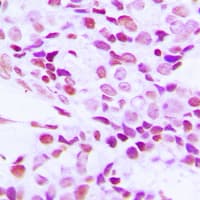 Polyclonal Rabbit anti-Human RBMX Antibody (N-Terminus, IHC, IF, WB)