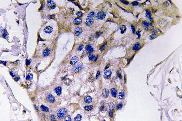 Polyclonal Rabbit anti-Human IL5 Antibody (Ser92, IHC, WB)