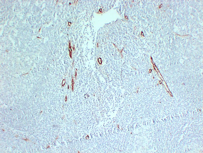 Monoclonal Mouse anti-Human CD105 Antibody (clone ABT-CD105, IHC)