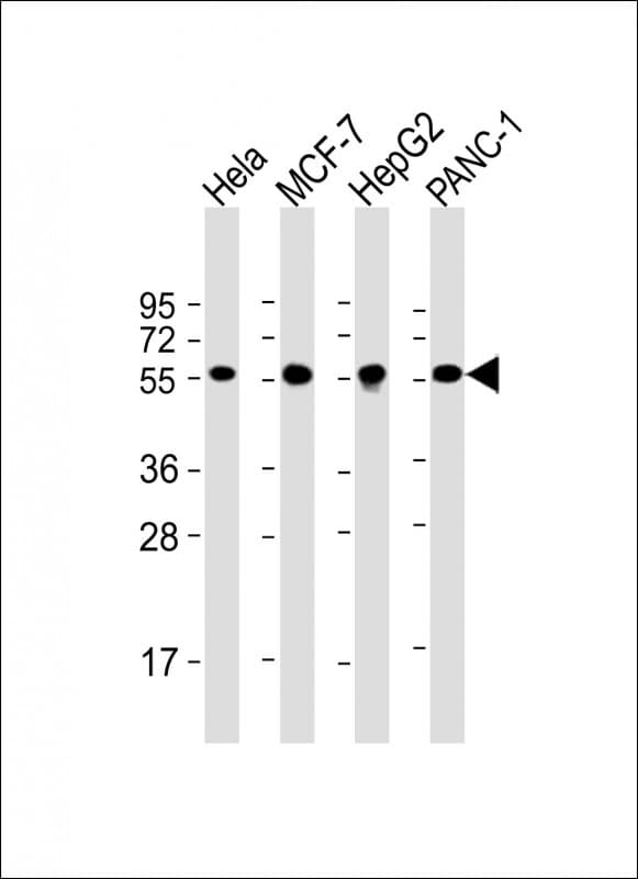 PDI / P4HB Antibody (clone 1530CT836.11.53)