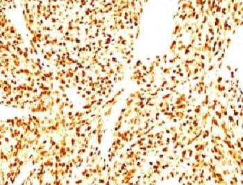 MYOD / MYOD1 Antibody (clone SPM427)