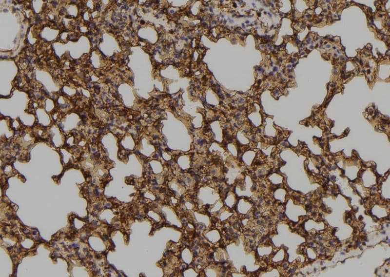 Polyclonal Rabbit anti-Human ZNF768 Antibody (IHC, WB)