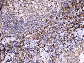 Polyclonal Rabbit anti-Human LDHB / Lactate Dehydrogenase B Antibody (IHC, WB)