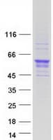 Human OLFML3 Protein (Recombinant Myc-DDK (Flag))