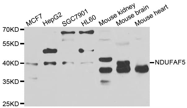 Polyclonal Rabbit anti-Human NDUFAF5 Antibody (IHC, WB)