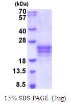 Human IL9 Protein (Recombinant His)