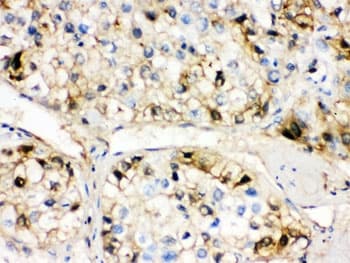 AHSG / Fetuin A Antibody