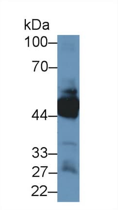 KRT33A / Keratin 33A / KRTHA3A Antibody (aa57-363)