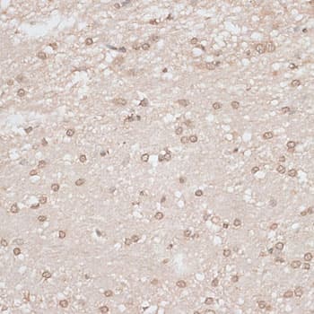 Polyclonal Rabbit anti-Human GPKOW Antibody (IHC, WB)