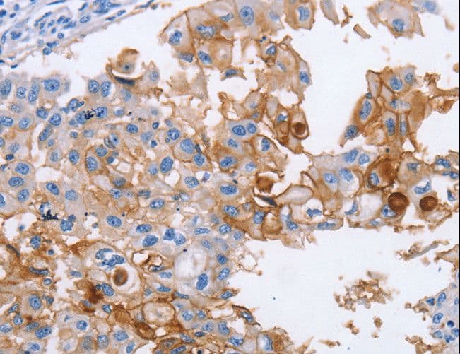 ICAM-1 / CD54 Antibody