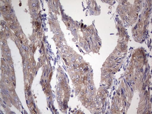 Monoclonal Mouse anti-Human PKM2 Antibody (clone 11B11, IHC, WB)