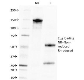 CMV / Cytomegalovirus Antibody (clone CMV100, Azide-free, BSA-free)
