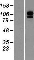 EFTUD2 Protein (Over-Expression Lysate Myc-DDK (Flag))