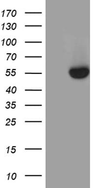 NR5A1 / SF1 Antibody (aa1-262, clone OTI1A2, Carrier-free)