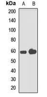 PFK2 / PFKFB3 Antibody