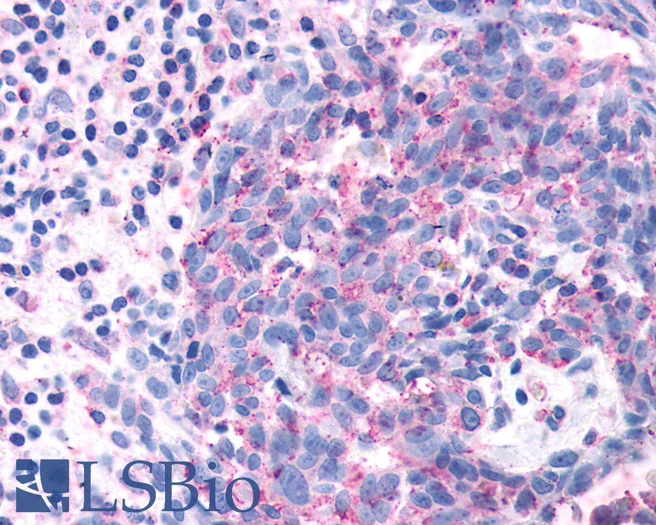 PathPlus™ Polyclonal Rabbit anti-Human OR2A4 Antibody (Extracellular Domain, IHC)