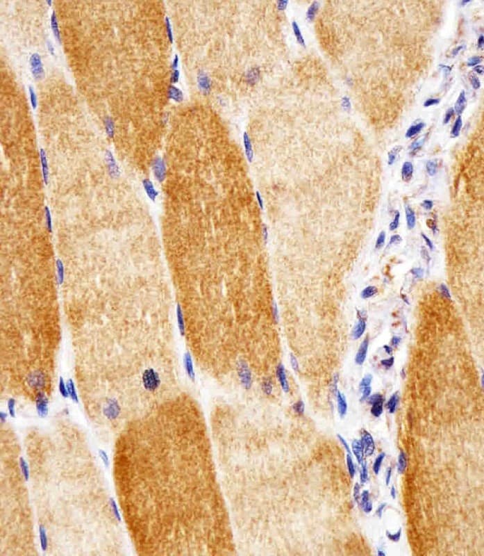 Monoclonal Mouse anti-Human SOD2 / Mn SOD Antibody (clone 1559CT572.3.83, IHC, WB)