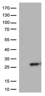 SSX4 Antibody (clone OTI2E10)
