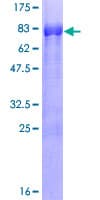 Human E2F4 Protein (Recombinant GST)